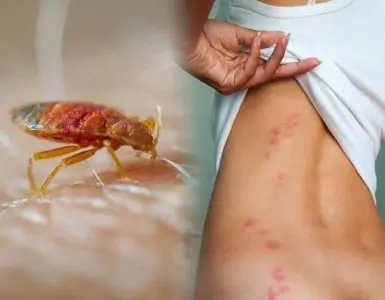 Rest Easy with Bedbug-Free Living - Professional Extermination Services in Mombasa
